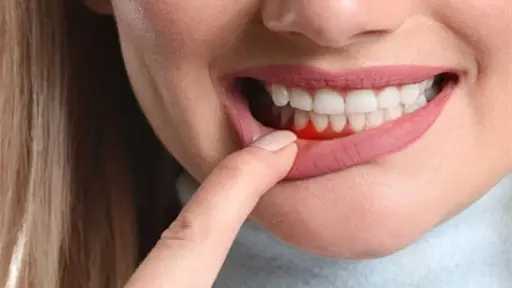 متنوعات